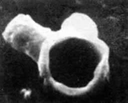 弗莱明发明青霉素(todayonhistory.com)