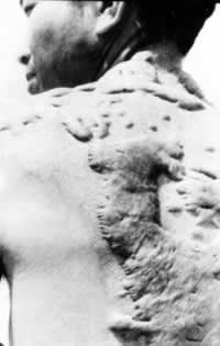 广岛原子弹爆炸（TodayOnHistory.com）