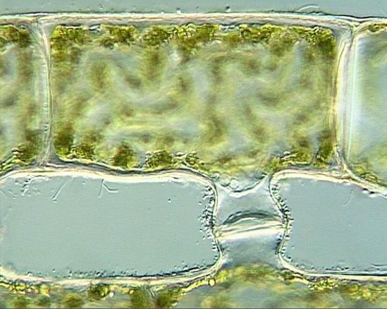 最佳年度生物显微照片，水蚤微观照居首(todayonhistory.com)