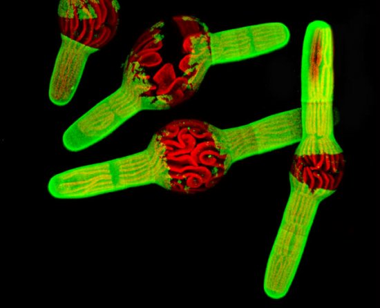 最佳年度生物显微照片，水蚤微观照居首(todayonhistory.com)