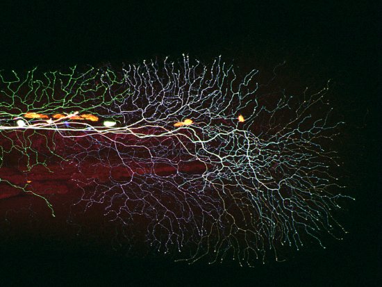 最佳年度生物显微照片，水蚤微观照居首(todayonhistory.com)